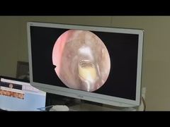 دستگاه جراحی ژنراتور پلازما با فرکانس بالا