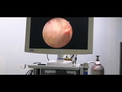 الکترود اورولوژی سیستم جراحی پلاسما RF برای هیپرپلازی خوش خیم پروستات